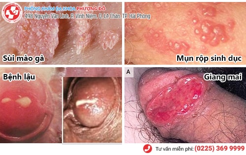 Tiết lộ nguyên nhân quan hệ bị ngứa ở nam và nữ Tiết lộ nguyên nhân quan hệ bị ngứa ở nam và nữ