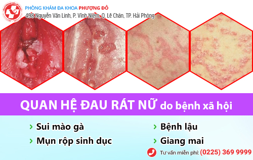 quan hệ đau rát nữ quan hệ đau rát nữ