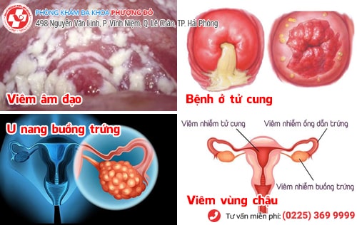 Rát vùng kín do đâu? Địa chỉ chữa trị uy tín hiện nay