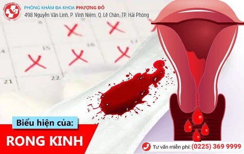 Rong kinh là gì? Cách chữa rong kinh hiệu quả Rong kinh là gì? Cách chữa rong kinh hiệu quả