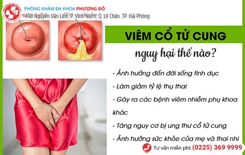 Viêm cổ tử cung gây ra nhiều biến chứng nguy hiểm Viêm cổ tử cung gây ra nhiều biến chứng nguy hiểm