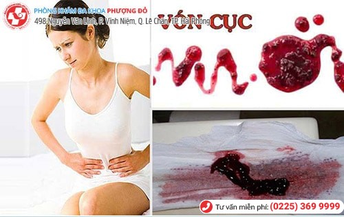 Những tác hại nghiêm trọng nếu không điều trị bệnh phụ khoa Những tác hại nghiêm trọng nếu không điều trị bệnh phụ khoa