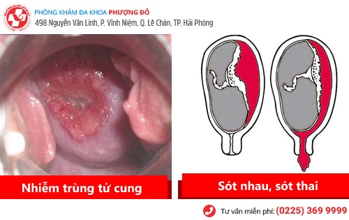 tác hại phá thai không an toàn