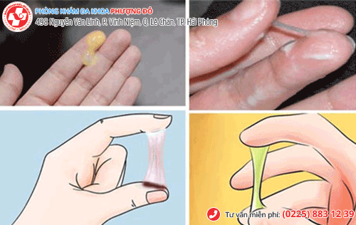 huyết trắng có màu huyết trắng có màu