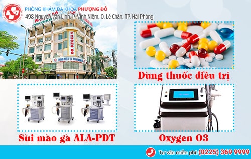 Thịt thừa vùng kín nam, nữ là bị bệnh gì?