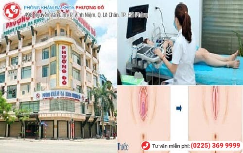 thu nhỏ âm đạo thu nhỏ âm đạo