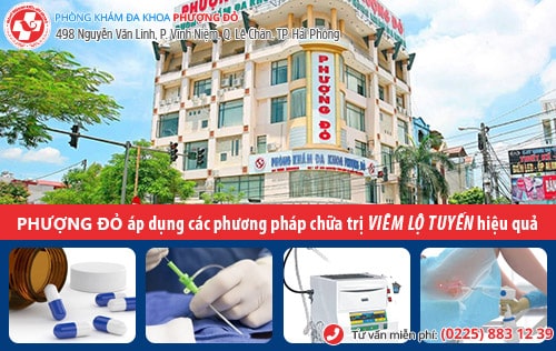 Thuốc trị viêm lộ tuyến loại nào tốt?