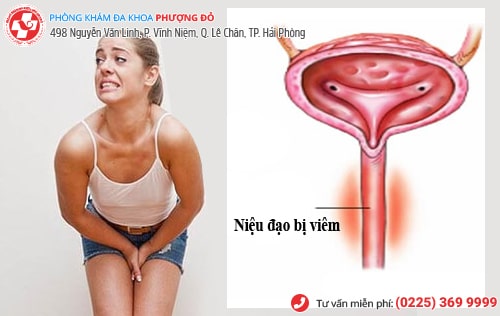 Thuốc viêm niệu đạo có hiệu quả không? Thuốc viêm niệu đạo có hiệu quả không?