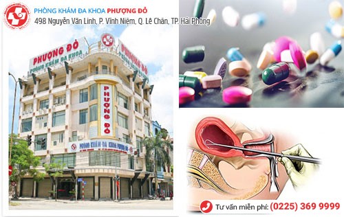 Tổng hợp các phương pháp bỏ thai theo tuần tuổi an toàn Tổng hợp các phương pháp bỏ thai theo tuần tuổi an toàn