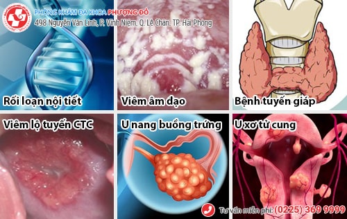 Trễ kinh là dấu hiệu bệnh gì? Trễ kinh có thai không?
