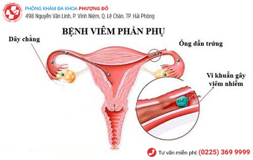 viêm phần phụ