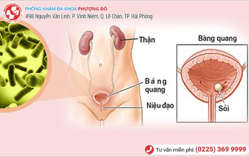 nhiễm khuẩn đường tiểu