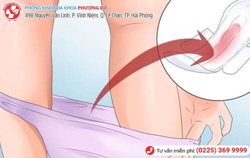 Viêm vùng kín Viêm vùng kín