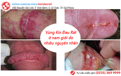 Đau vùng kín