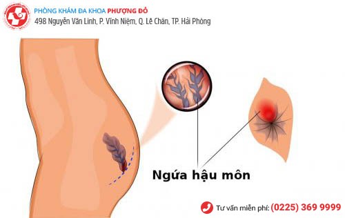 Ngứa Hậu Môn