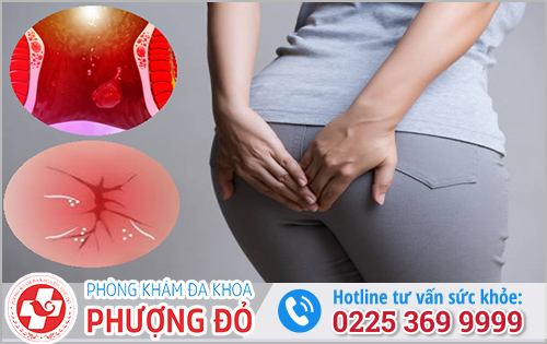 Bệnh trĩ nguy hiểm thế nào?