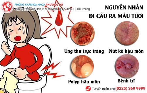 Nguyên nhân đi cầu ra máu tươi Nguyên nhân đi cầu ra máu tươi