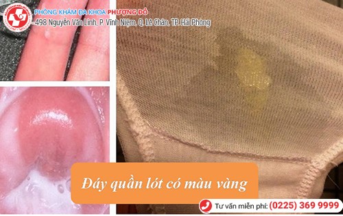 âm đạo ra mủ vàng, âm đạo ra dịch vàng