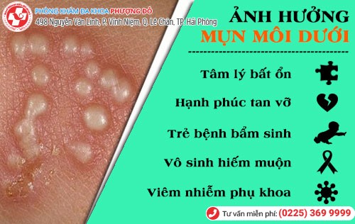 Ảnh hưởng khi bị mụn môi dưới kéo dài Ảnh hưởng của mụn môi dưới