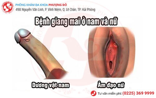 Tổng quan về bệnh giang mai Bệnh giang mai
