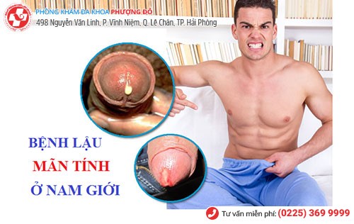Hình ảnh lậu giai đoạn mãn tính ở nam Hình ảnh lậu giai đoạn mãn tính ở nam