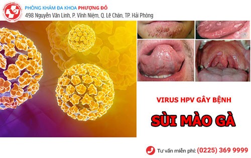 Sùi mào gà cần được chữa trị sớm Sùi mào gà cần được chữa trị sớm