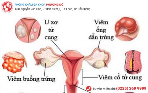 bệnh vùng kín nữ