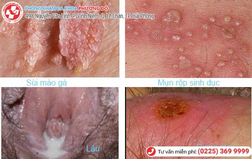 Bệnh xã hội Bệnh xã hội