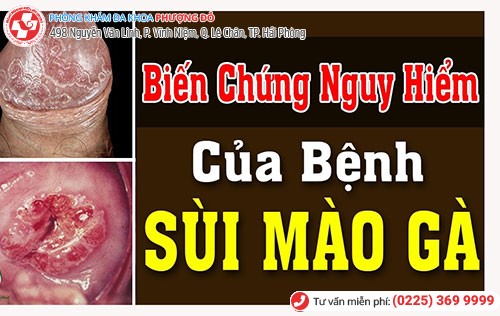Ung thư dương vật, cổ tử cung - biến chứng nguy hiểm nhất khi nhiễm virus HPV Ung thư dương vật, cổ tử cung - biến chứng nguy hiểm nhất khi nhiễm virus HPV