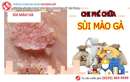 Chi phí chữa sùi mào gà phụ thuộc nhiều yếu tố khác nhau Chi phí chữa sùi mào gà phụ thuộc nhiều yếu tố khác nhau
