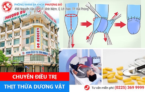 Nam giới cần cảnh giác với thịt thừa dương vật