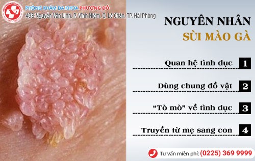 Nguyên nhân dẫn đến sùi mào gà ở nam và nữ Nguyên nhân sùi mào gà