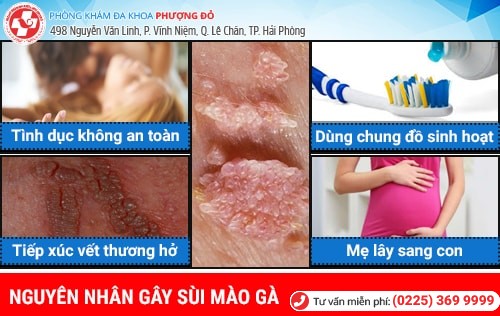 nguyên nhân sùi mào gà nguyên nhân sùi mào gà