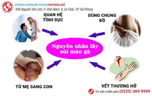 nguyên nhân sùi mào gà nguyên nhân sùi mào gà
