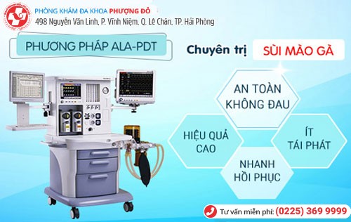 Đa Khoa Phượng Đỏ chuyên sử dụng phương pháp ALA-PDT chữa bệnh Phương pháp ALA-PDT hỗ trợ điều trị sùi mào gà