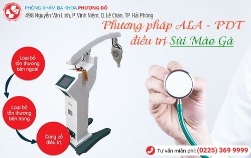 ALA - PDT - phương pháp chữa sùi mào gà hiệu quả ALA - PDT - phương pháp chữa sùi mào gà hiệu quả