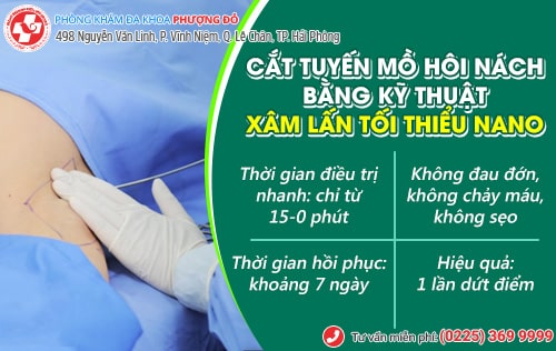 Cắt tuyến mồ hôi nách liệu có phải là giải pháp an toàn? Cắt tuyến mồ hôi nách liệu có phải là giải pháp an toàn?