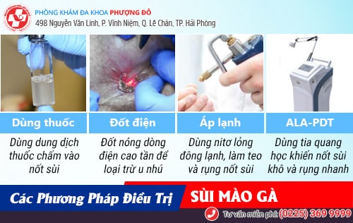 Biểu hiện sùi mào gà trên từng vị trí cơ thể dễ nhận biết sớm nhất Biểu hiện sùi mào gà trên từng vị trí cơ thể dễ nhận biết sớm nhất