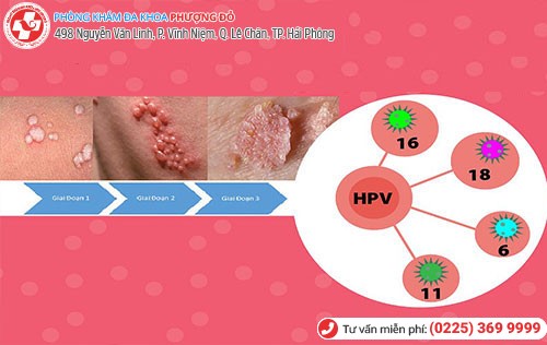 HPV gây sùi mào gà