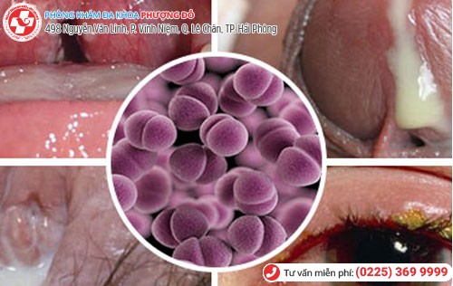 Nhóm bệnh xã hội gây ra nhiều biên chứng nguy hiểm Nhóm bệnh xã hội gây ra nhiều biên chứng nguy hiểm