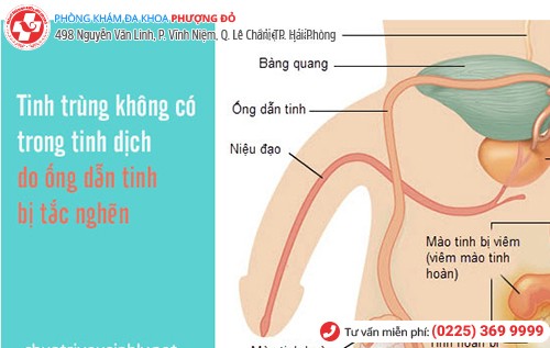 biến chứng bệnh lậu ở nam