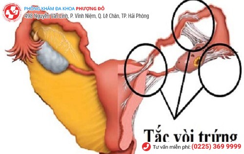 biến chứng mụn rộp sinh dục nữ