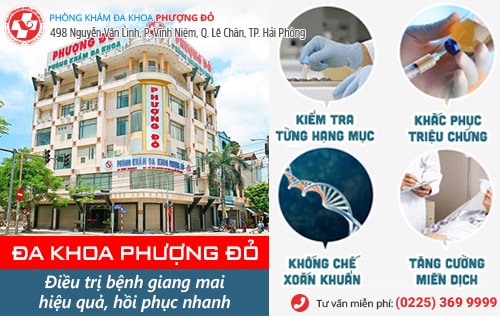 Thuốc điều trị bệnh giang mai có những loại nào? Hiệu quả ra sao?