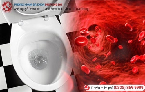 Hiện tượng tiểu buốt ra máu Tiểu buốt ra máu là bệnh gì?