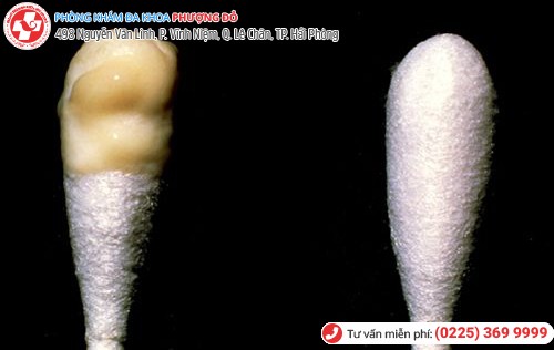 xét nghiệm dịch